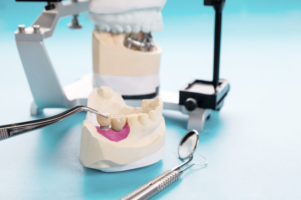 servicii de protetică dentară